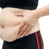 Fatty Liver Disease Symptoms: Cellulite