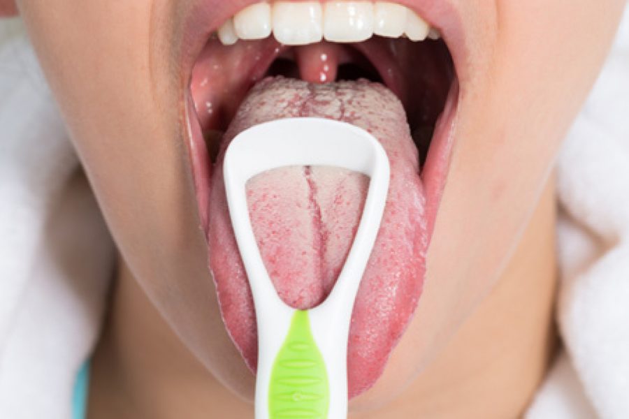 White Tongue Is One of the Fatty Liver Symptoms
