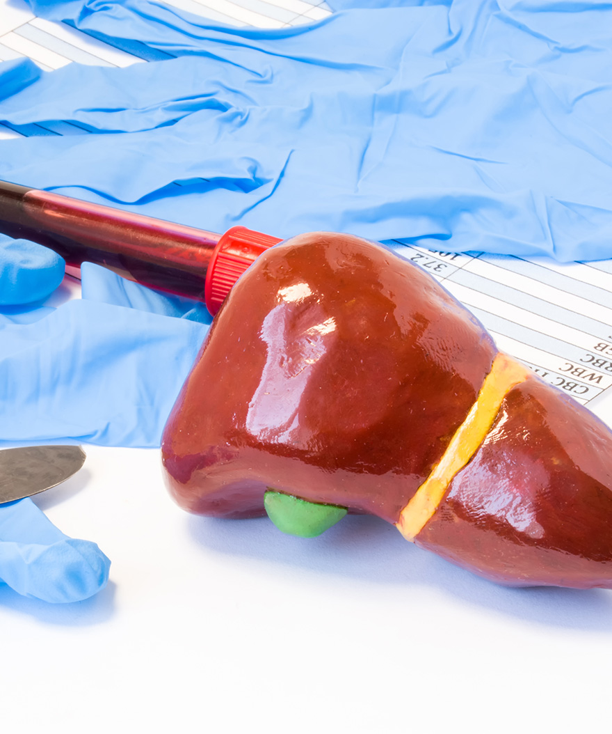 Did You Know That Gallbladder Disease Often Causes No Symptoms?