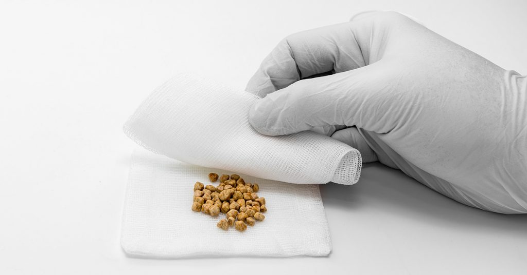 Understanding Gallstones To Achieve Gallbladder Pain Relief fb Remove 