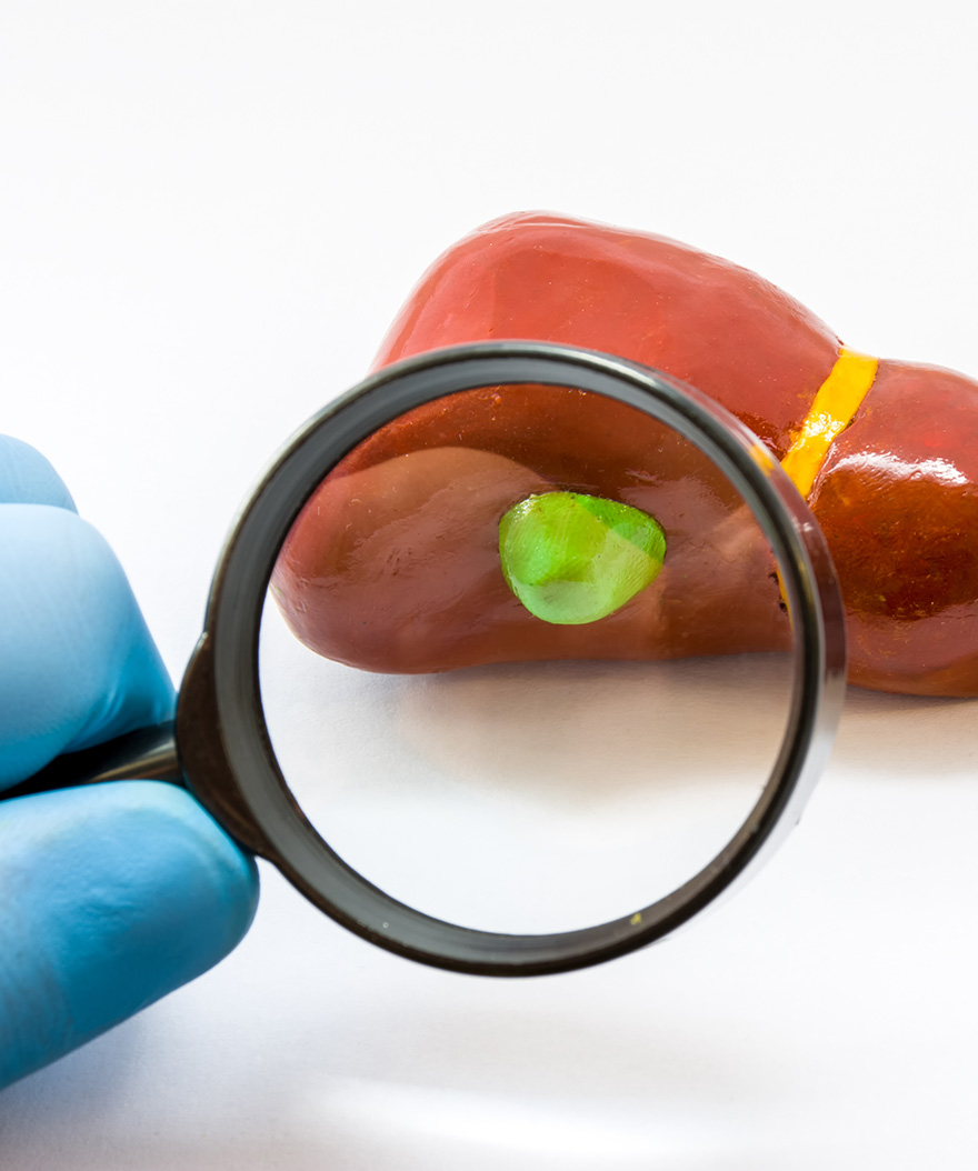 Gallbladder Pain – Do You Recognize The Symptoms?